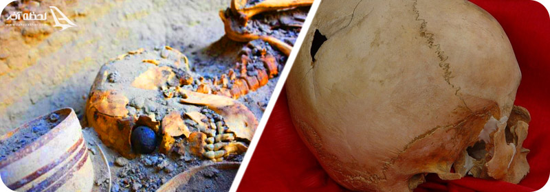 چشم مصنوعی در شهر سوخته